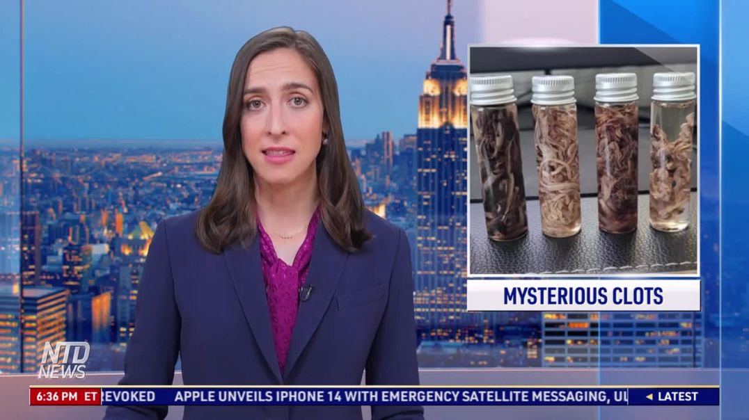 ⁣Strange New Blood Clots In Most Bodies Embalmers