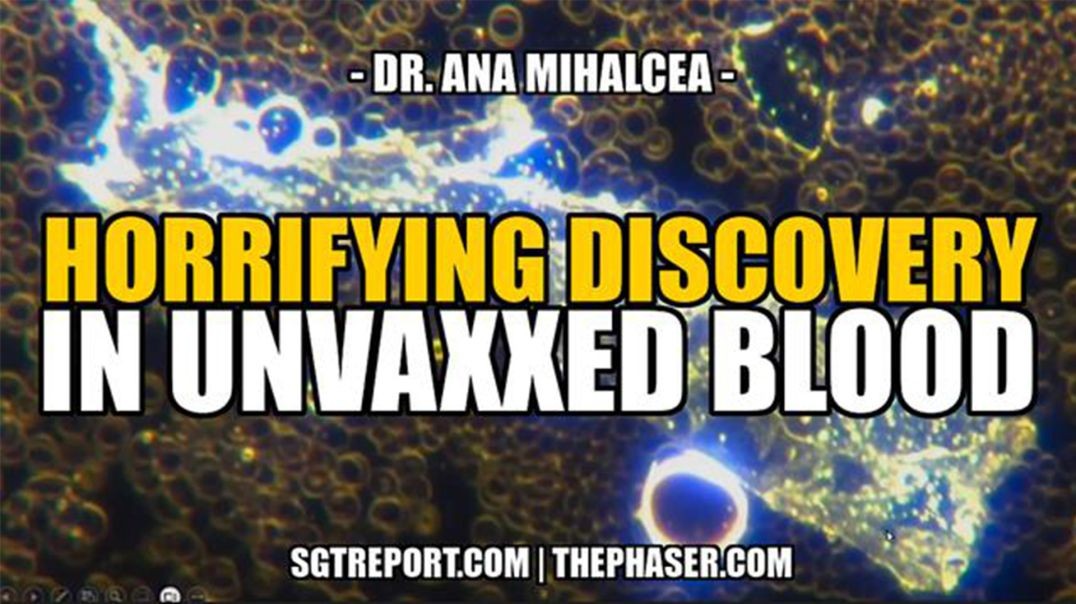 HORRIFYING DISCOVERY IN UNVAXXED BLOOD -- DR. ANA MIHALCEA